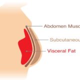 How To Lose Belly and Visceral Fat, According to Science