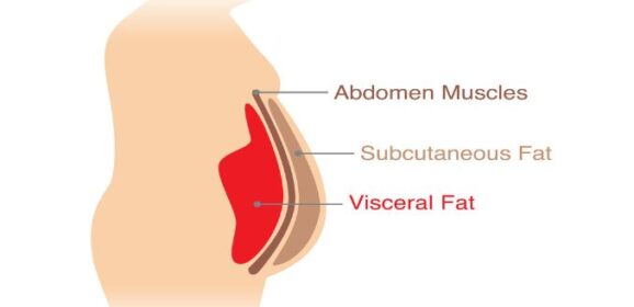 How To Lose Belly and Visceral Fat, According to Science